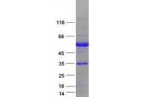 Validation with Western Blot