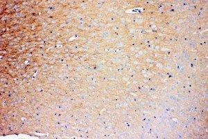 Anti-Prion protein PrP antibody, IHC(P) IHC(P): Rat Brain Tissue (PRNP 抗体  (Middle Region))