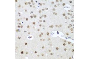 Immunohistochemistry of paraffin-embedded mouse brain using UTP14A antibody (ABIN5974631) at dilution of 1/100 (40x lens). (UTP14A 抗体)