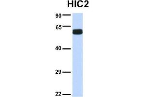 Host:  Rabbit  Target Name:  HIC2  Sample Type:  Human Fetal Brain  Antibody Dilution:  1. (HIC2 抗体  (Middle Region))