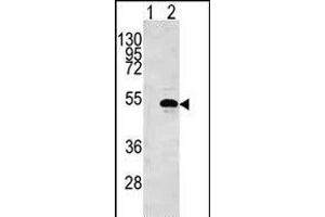 Western blot analysis of CKB (arrow) using rabbit polyclonal CKB Antibody (N5) (ABIN391073 and ABIN2841220). (CKB 抗体  (N-Term))