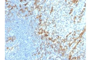 Formalin-fixed, paraffin-embedded human tonsil stained with Podoplanin Recombinant Rabbit Monoclonal Antibody (PDPN/4009R). (Recombinant Podoplanin 抗体  (AA 1-100))