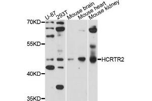 Western blot analysis of extracts of mouse heart cell line, using HCRTR2 antibody. (HCRTR2 抗体)