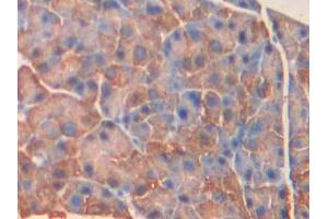DAB staining on IHC-P; Samples: Mouse Pancreas Tissue (MYLK4 抗体  (AA 96-353))