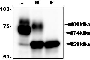 Western Blotting (WB) image for anti-HHV6 gQ1 (AA 3-422) antibody (ABIN2452012) (HHV6 gQ1 (AA 3-422) 抗体)