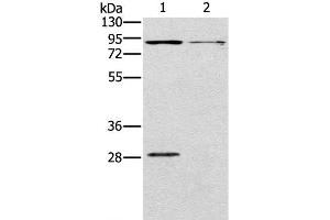 Western Blot analysis of Mouse kidney and brain tissue using CNGA3 Polyclonal Antibody at dilution of 1:500 (CNGA3 抗体)