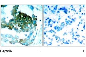 Image no. 1 for anti-Protein Kinase C, theta (PRKCQ) (AA 693-697) antibody (ABIN197401) (PKC theta 抗体  (AA 693-697))