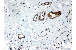 Immunohistochemistry (IHC) image for anti-Heat Shock 22kDa Protein 8 (HSPB8) (AA 1-196) antibody (ABIN5518846)