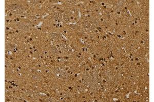 ABIN6269010 at 1/100 staining Rat brain tissue by IHC-P. (HSPA9 抗体  (C-Term))