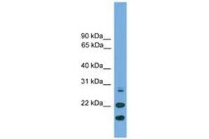 Image no. 1 for anti-ASF1 Anti-Silencing Function 1 Homolog A (S. Cerevisiae) (ASF1A) (N-Term) antibody (ABIN6745605) (ASF1A 抗体  (N-Term))