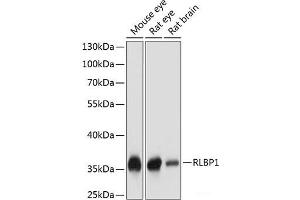 Western blot analysis of extracts of various cell lines using RLBP1 Polyclonal Antibody at dilution of 1:1000. (RLBP1 抗体)