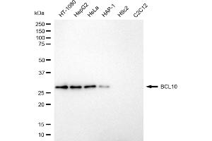 Western blotting analysis using BCL10 antibody (ABIN7800913). (Recombinant BCL10 Immune Signaling Adaptor 抗体)