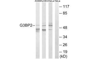 Western blot analysis of extracts from A549 cells, HUVEC cells and HeLa cells, using G3BP2 antibody. (G3BP2 抗体  (C-Term))