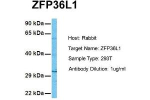Host: Rabbit Target Name: ZFP36L1 Sample Tissue: Human 293T Antibody Dilution: 1.