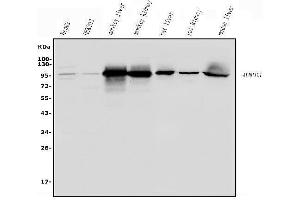 Western blot analysis of ALDH1L1 using anti-ALDH1L1 antibody (ABIN7601093). (ALDH1L1 抗体  (AA 282-424))