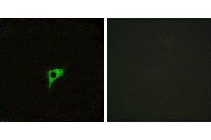 Peptide - +Western blot analysis of extracts from MCF-7 cells and HeLa cells, using CHRM2 antibody. (Muscarinic Acetylcholine Receptor M2 抗体  (Internal Region))