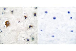 Peptide - +Immunohistochemical analysis of paraffin-embedded human brain tissue using Connexin 43 antibody. (Connexin 43/GJA1 抗体)