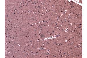 (ABIN263162) (8 μg/mL) staining of paraffin embedded Human Cortex. (DHX58 抗体  (C-Term))
