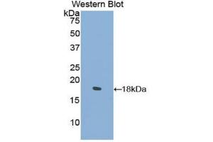 Western blot analysis of the recombinant protein. (COL2A1 抗体  (AA 677-817))