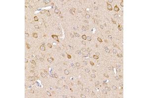 Immunohistochemistry of paraffin-embedded mouse brain using [KO Validated] TR Rabbit pAb (ABIN3021164, ABIN3021165, ABIN3021166 and ABIN1513640) at dilution of 1:250 (40x lens). (TRAF2 抗体  (AA 1-300))