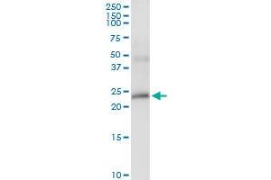 Immunoprecipitation of BTC transfected lysate using anti-BTC MaxPab rabbit polyclonal antibody and Protein A Magnetic Bead , and immunoblotted with BTC purified MaxPab mouse polyclonal antibody (B02P) . (Betacellulin 抗体  (AA 1-178))
