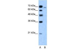 WB Suggested Anti-MLLT4  Antibody Titration: 1. (Afadin 抗体  (N-Term))