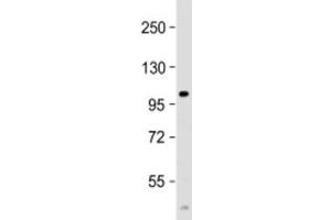Western blot testing of human spleen lysate with PARP10 antibody at 1:2000.