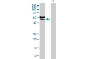 Western Blot analysis of GCNT2 expression in transfected 293T cell line by GCNT2 MaxPab polyclonal antibody. (GCNT2 抗体  (AA 1-402))