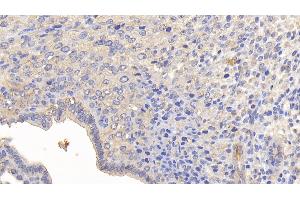 Detection of MMP13 in Mouse Uterus Tissue using Polyclonal Antibody to Matrix Metalloproteinase 13 (MMP13) (MMP13 抗体  (AA 66-238))