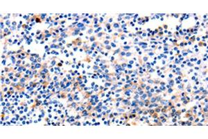 Immunohistochemistry of paraffin-embedded Human tonsil tissue using GADD45 gamma Polyclonal Antibody at dilution 1:120 (GADD45G 抗体)