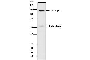 Western blot analysis of Kininogen 1 expression in Human platelet lysate.
