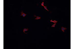 Immunofluorescence (fixed cells) (IF/ICC) image for anti-Protein Kinase C, zeta (PRKCZ) (C-Term) antibody (ABIN6264247)