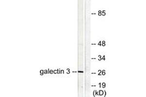 Western blot analysis of extracts from HeLa cells, using Galectin 3 Antibody. (Galectin 3 抗体  (AA 141-190))