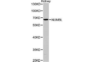 Western blot analysis of extracts of Kidney cells, using NUMBL antibody (ABIN5971167).