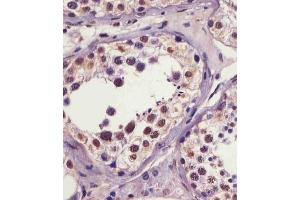 (ABIN6241064 and ABIN6578961) staining IRAK1 in human testis tissue sections by Immunohistochemistry (IHC-P - paraformaldehyde-fixed, paraffin-embedded sections). (IRAK1 抗体  (pSer376))