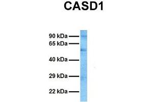 Host:  Rabbit  Target Name:  CASD1  Sample Tissue:  Human HT1080  Antibody Dilution:  1. (CASD1 抗体  (N-Term))