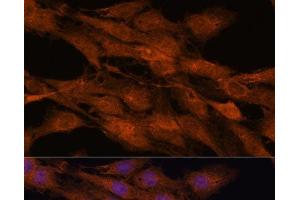 Immunofluorescence analysis of C6 cells using COMMD5 Polyclonal Antibody at dilution of 1:100. (COMMD5 抗体)