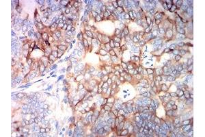 Immunohistochemistry (IHC) image for anti-Tubulin, beta 3 (TUBB3) antibody (ABIN7193512)