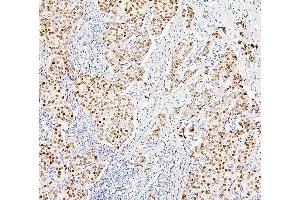 IHC analysis of H1F0 using anti-H1F0 antibody (ABIN7600521).