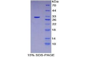 SDS-PAGE analysis of Human Checkpoint Homolog 2 Protein. (CHEK2 蛋白)