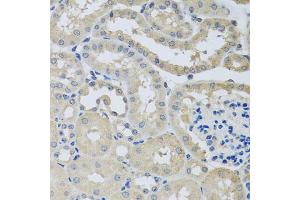 Immunohistochemistry of paraffin-embedded mouse kidney using CHMP1B antibody (ABIN5974811) at dilution of 1/100 (40x lens). (CHMP1B 抗体)