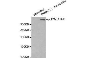 Western blot analysis of extracts of 293 cells, using phospho-ATM-S1981 antibody. (ATM 抗体  (pSer1981))