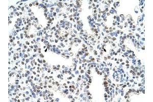 WDR6 antibody was used for immunohistochemistry at a concentration of 4-8 ug/ml to stain Alveolar cells (arrows) in Human Lung. (WDR6 抗体  (C-Term))