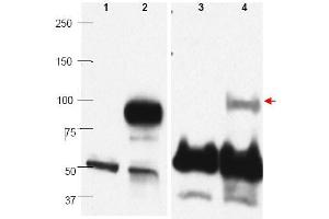 Image no. 1 for anti-PR Domain Containing 1, with ZNF Domain (PRDM1) (C-Term) antibody (ABIN401477) (PRDM1 抗体  (C-Term))