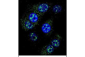 Confocal immunofluorescent analysis of MGMT Antibody (N-term) (ABIN657769 and ABIN2846745) with MCF-7 cell followed by Alexa Fluor 488-conjugated goat anti-rabbit lgG (green). (MGMT 抗体  (N-Term))