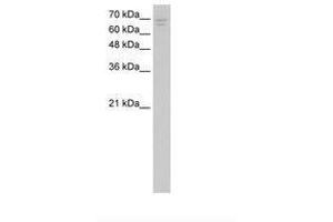 Image no. 1 for anti-Calcium Channel, Voltage-Dependent, beta 2 Subunit (CACNB2) (AA 394-443) antibody (ABIN204951)