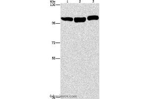 Western blot analysis of Hela, NIH/3T3 and Raji cell, using DNM2 Polyclonal Antibody at dilution of 1:400 (DNM2 抗体)