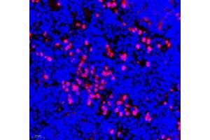 Immunofluorescence of paraffin embedded mouse spleen using ANXA3 (ABIN7073065) at dilution of 1: 300 (400x lens) (Annexin A3 抗体)