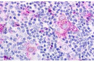 Image no. 1 for anti-Chemokine-Like Receptor 1 (CMKLR1) (N-Term) antibody (ABIN1048448) (CMKLR1 抗体  (N-Term))