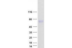 Western Blotting (WB) image for Activin Receptor Type I (ACRV1) (Transcript Variant 1) protein (Myc-DYKDDDDK Tag) (ABIN2714363)